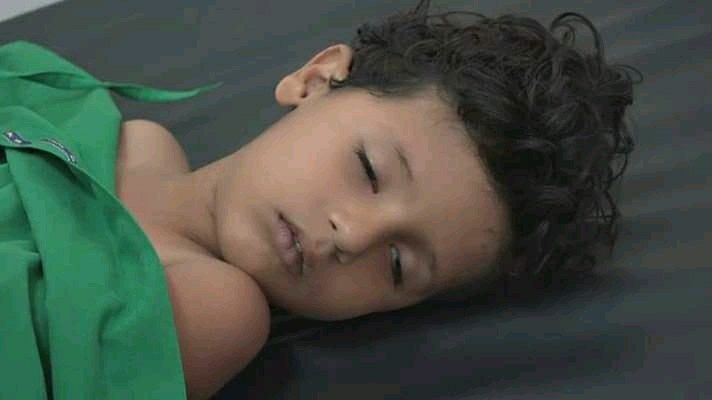 استشهاد طفل وإصابة آخر بانفجار لغم حوثي شرقي الحديدة