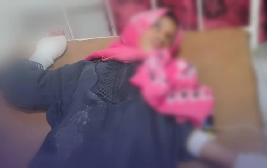 إصابة طفلة في إنفجار لغم حوثي غربي تعز